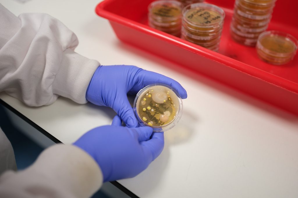 Microbiologist checking plate counts in the laboratory